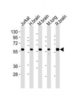 PPP2R1B Mouse Monoclonal Antibody
