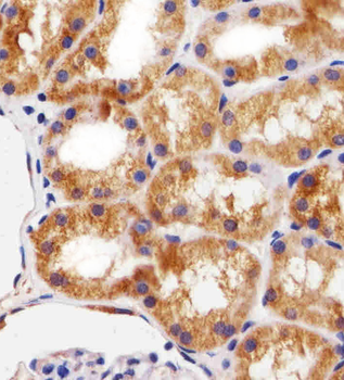BCL10 Mouse Monoclonal Antibody