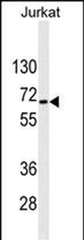 RPS6KB2 Mouse Monoclonal Antibody