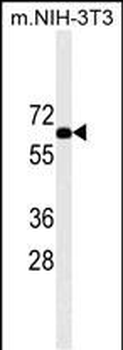 RPS6KB2 Mouse Monoclonal Antibody