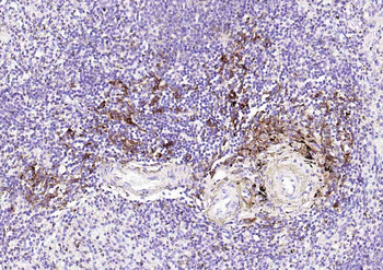 HLA-DR Recombinant Rabbit Monoclonal Antibody