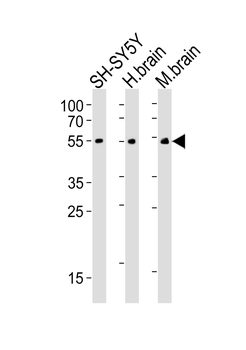 CHRM2 Mouse Monoclonal Antibody