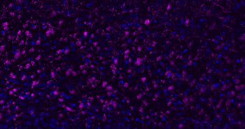 MBP Rabbit Polyclonal Antibody