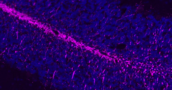 MBP Rabbit Polyclonal Antibody