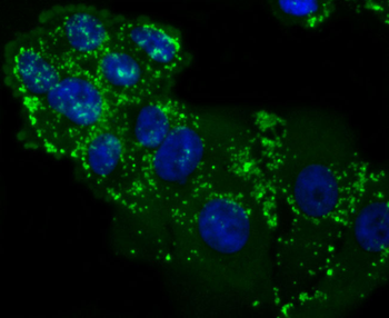 LXR alpha Recombinant Rabbit Monoclonal Antibody