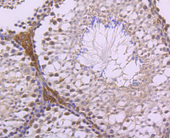 LXR alpha Recombinant Rabbit Monoclonal Antibody
