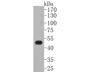 LXR alpha Recombinant Rabbit Monoclonal Antibody