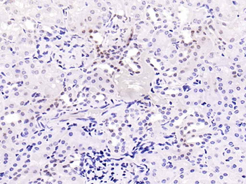 Phospho-Smad2 (Ser467) Rabbit Polyclonal Antibody