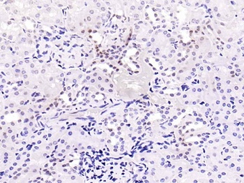 Smad2 (phospho-Ser467) antibody