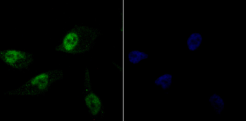 Histone H1.2 Recombinant Rabbit Monoclonal Antibody