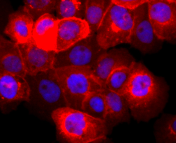 EGFR Recombinant Rabbit Monoclonal Antibody