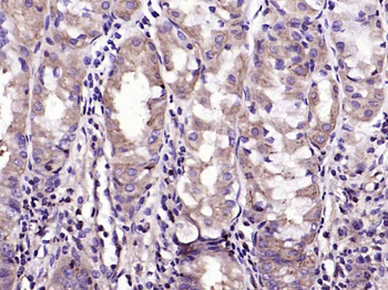 EGFR Recombinant Rabbit Monoclonal Antibody