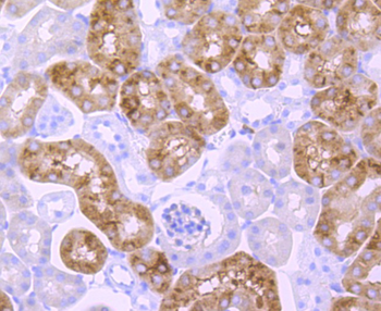 EGFR Recombinant Rabbit Monoclonal Antibody