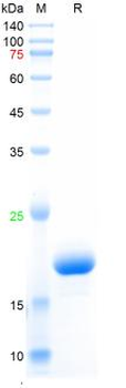 Recombinant human IL-1Ra protein, His
