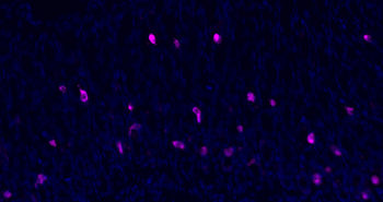 Donkey Anti-Rabbit IgG H&L, Cy5 conjugated