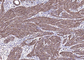Goat Anti-Mouse IgG H&L, HRP conjugated
