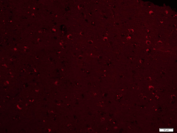 EGFR Mouse Monoclonal Antibody (Cy5)
