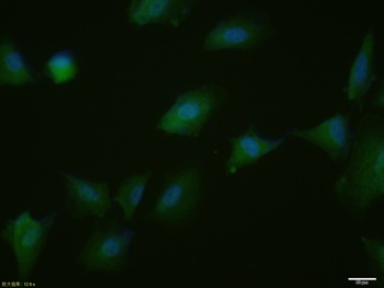 PPAR Gamma (phospho-ser112) antibody