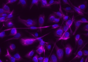 Vimentin Rabbit Polyclonal Antibody (APC)