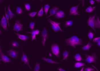 Vimentin Rabbit Polyclonal Antibody (APC)