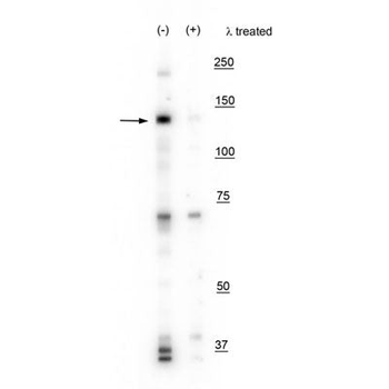 IRE1 (Ser724) Antibody