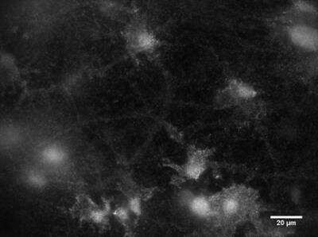 mGluR1 Antibody