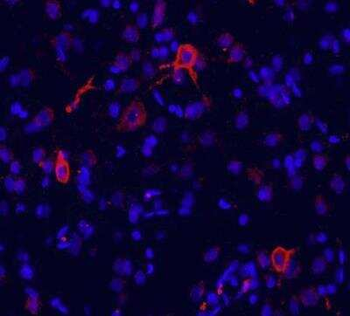 mGluR1 Antibody