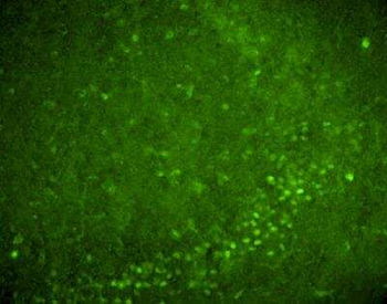 Nurr1 Antibody