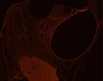 GLUT10 Antibody