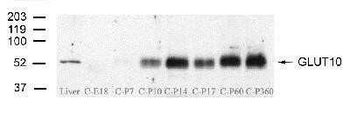 GLUT10 Antibody