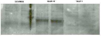 GLUT10 Antibody