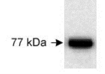 URP1 Antibody