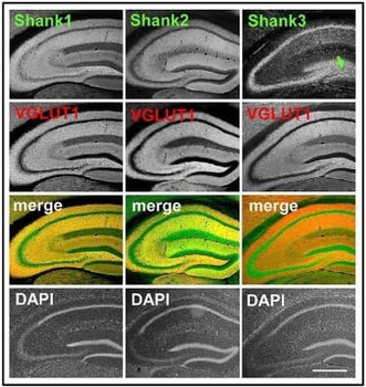 SHANK1a Antibody