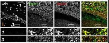 SHANK1a Antibody