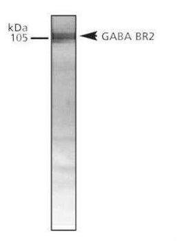 GABABR2 Antibody