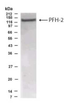 PHF2 Antibody