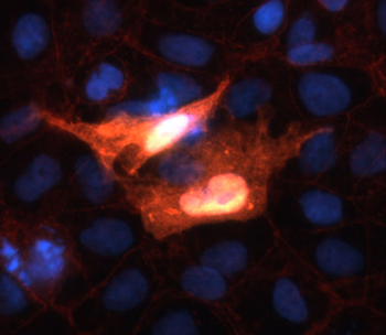 beta Catenin Antibody