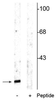 Alpha Synuclein (ser129) Antibody