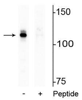 Androgen Receptor (Ser94) Antibody