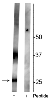 Aquaporin 2 (Ser261) Antibody