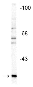 Calretinin Antibody