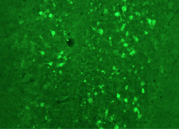 Calretinin Antibody