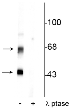 CaM Kinase II (Thr306) Antibody