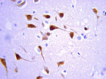 ChAT Antibody