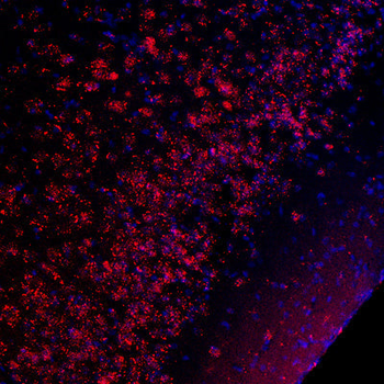 CREB (Ser133) Antibody