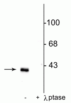 DARPP-32 (Thr75) Antibody