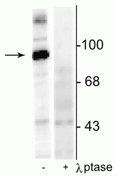 Dynamin (Ser774) Antibody