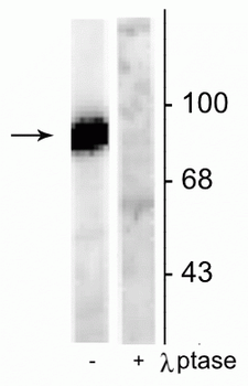 Dynamin (Ser778) Antibody