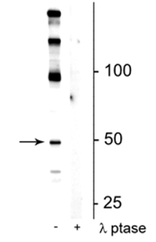 eEF1A2 (Ser358) Antibody