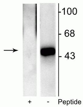 Elk-1 (Ser383) Antibody